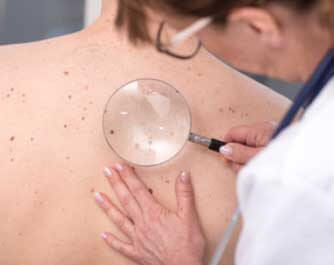 Dermatologist Homeopath for Skin Complaints