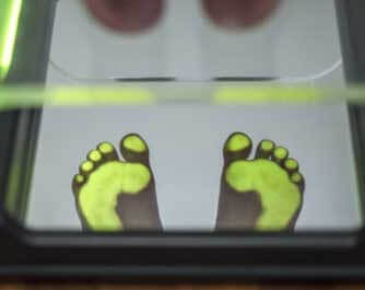 Podiatrist Walton Hall Foot Clinic